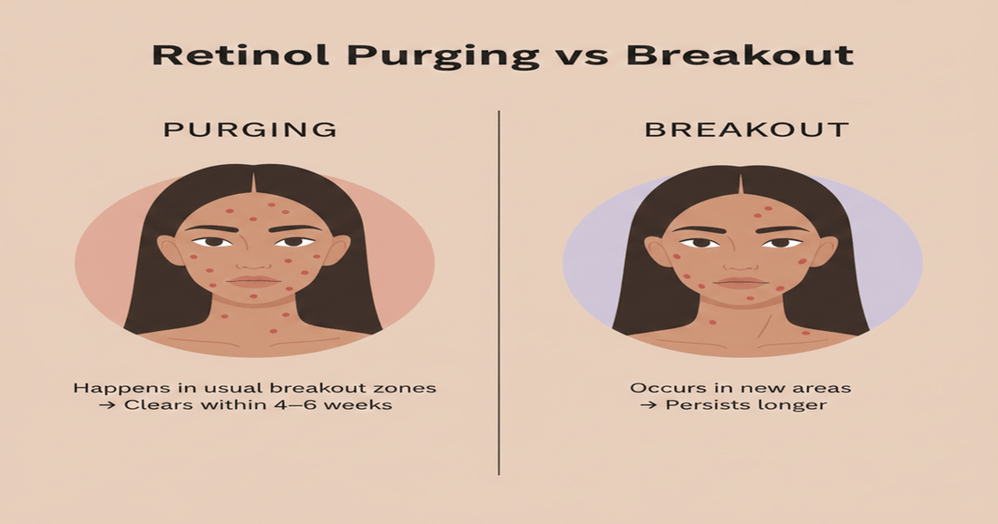 Acne vs Purging: How to Tell the Difference